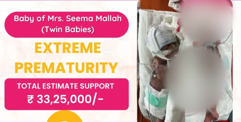 Baby of Mrs. Seema Mallah (Twin Babies)